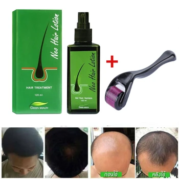 1 шт. Лосьон для волос Neo 120 мл, созданный по Сути, предотвращает выпадение волос, средство для ухода за кожей головы для роста волос у мужчин и женщин