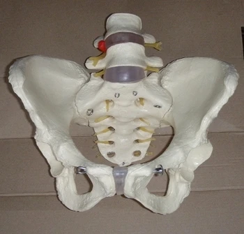 Модель женского таза 1:1, патологические изменения, модель человеческого скелета, медицинское обучение, бесплатная доставка